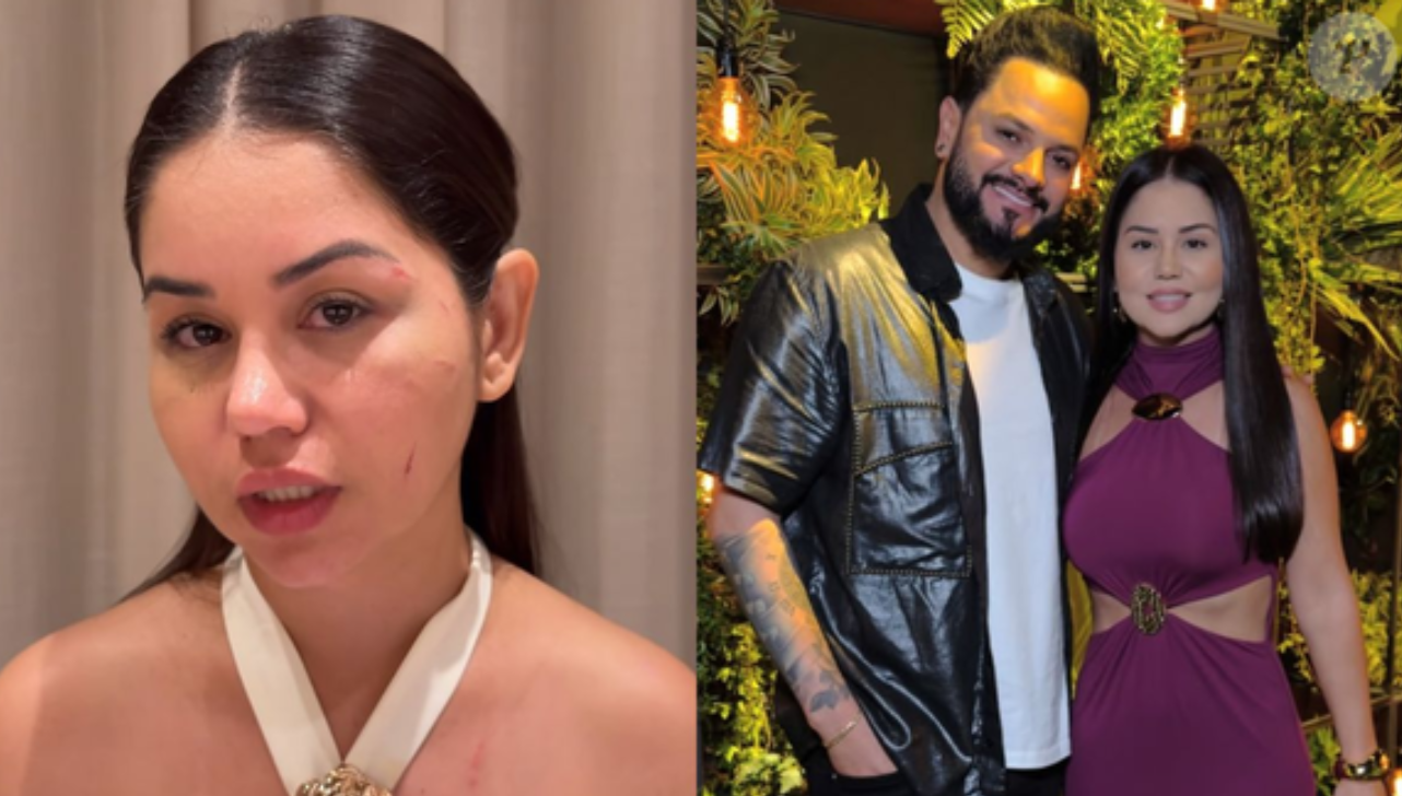 Esposa de Diego, da dupla com Victor Hugo, é agredida pela ex do sertanejo